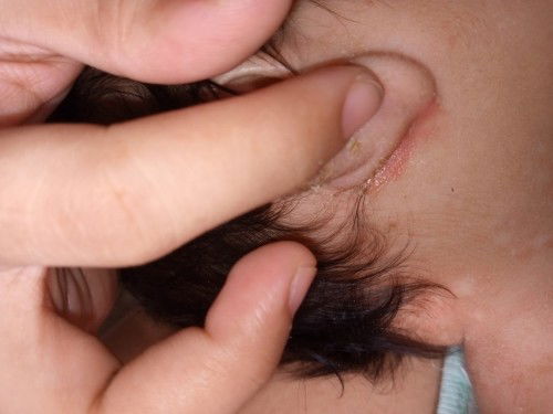 Hi mga momies tanong q lng normal po ba yung sa tenga ng baby q..?