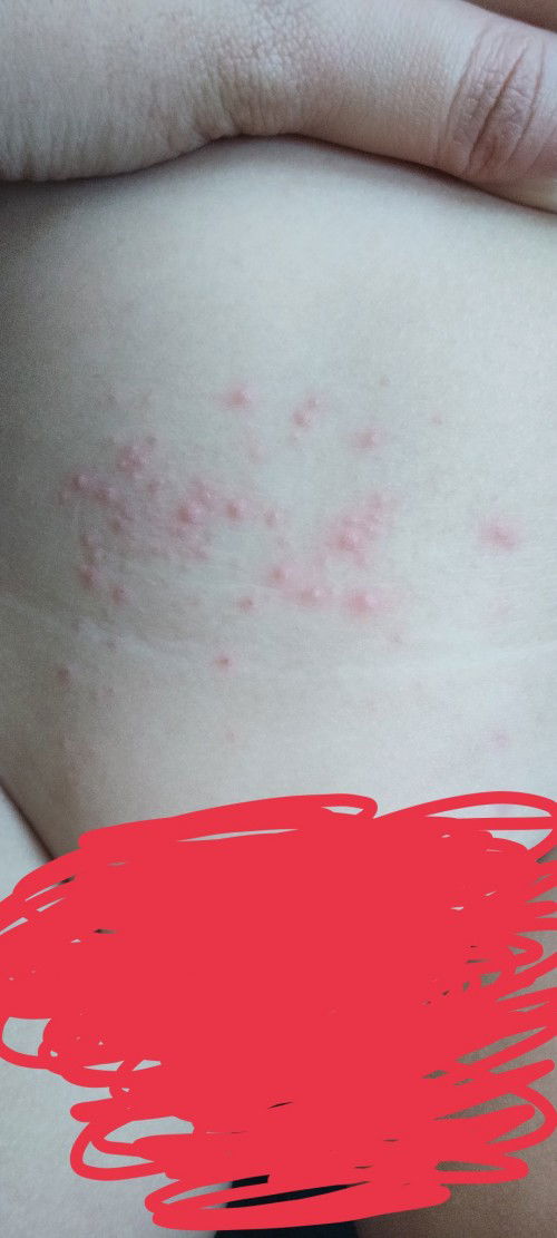 ano po kaya pwede ipahid dto ?