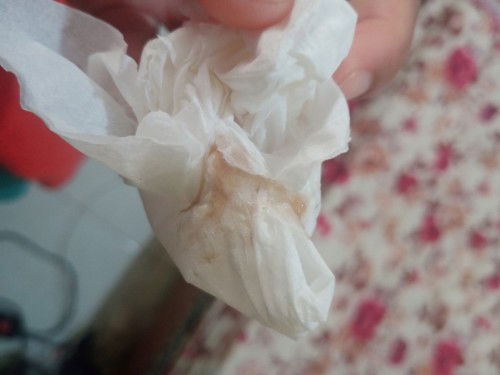 Flek di usia kehamilan 9minggu