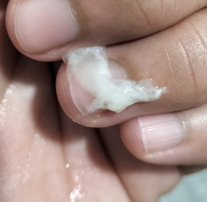 กำหนดคลอด 25 มกราคม