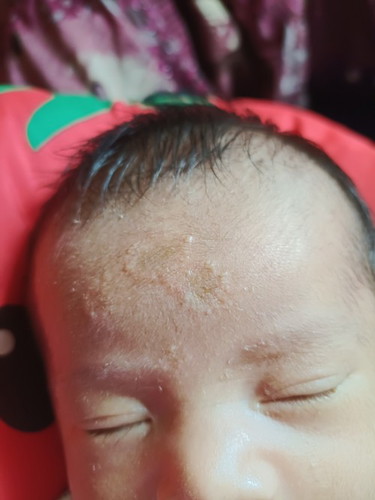 Kulit bAyi 2 mnggu