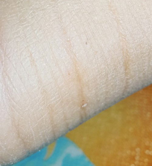 โดนเเมวข่วนค่ะ