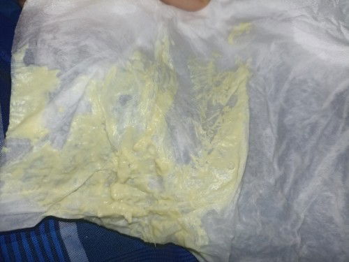 keputihan berlebihan