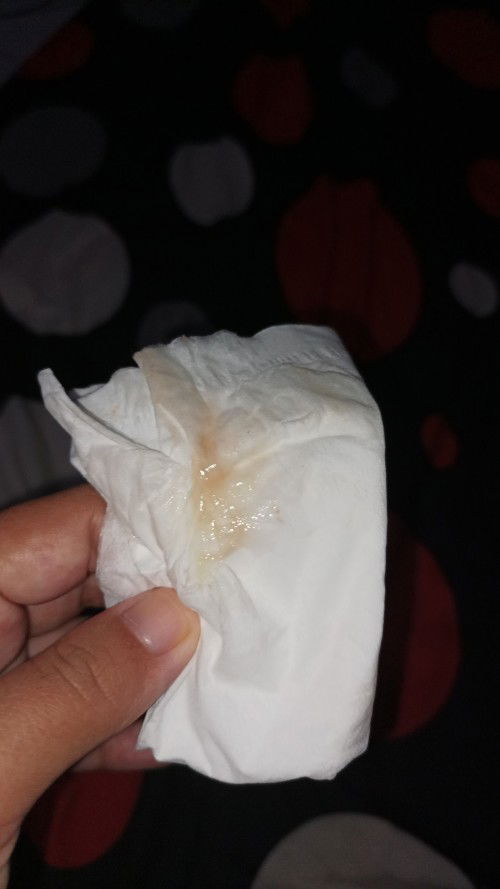 Apa kah ini tanda2 mau lahiran