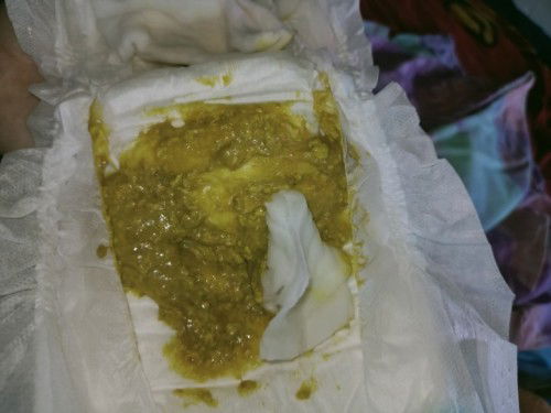 อึทารก2เดือน20วัน