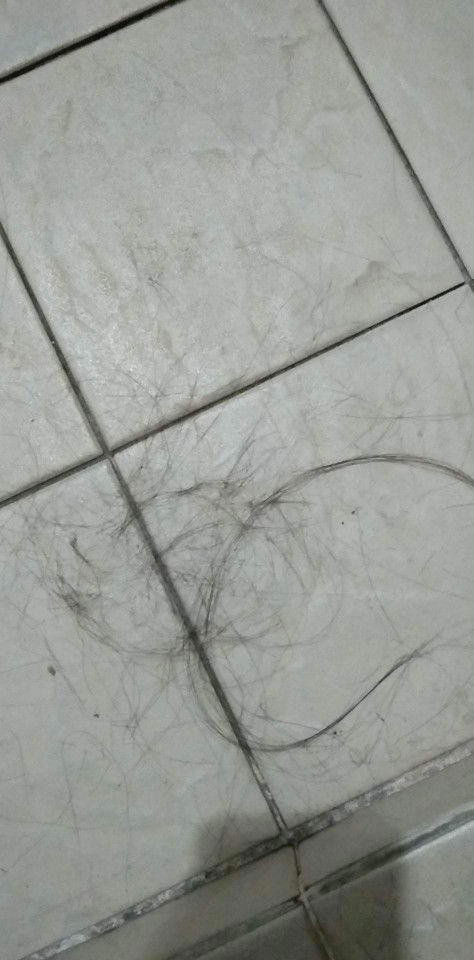 ผมร่วงเป็นช่อ