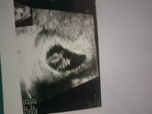 seneng banget berkat bunda semua