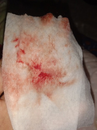 ผิดปกติมั้ยค่ะ