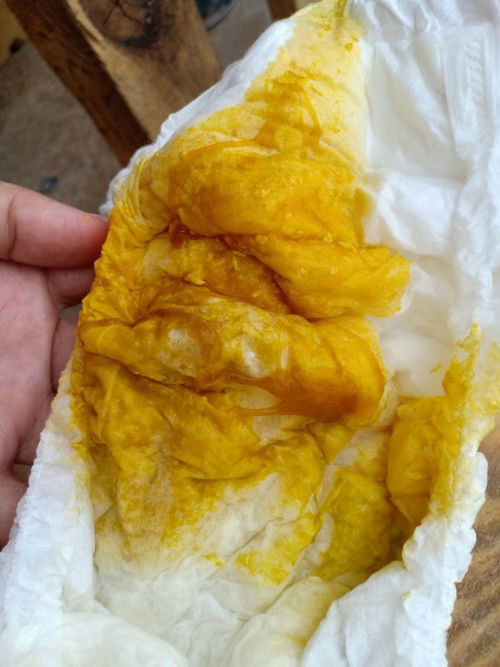 ทารกถ่ายเป็นเมือก