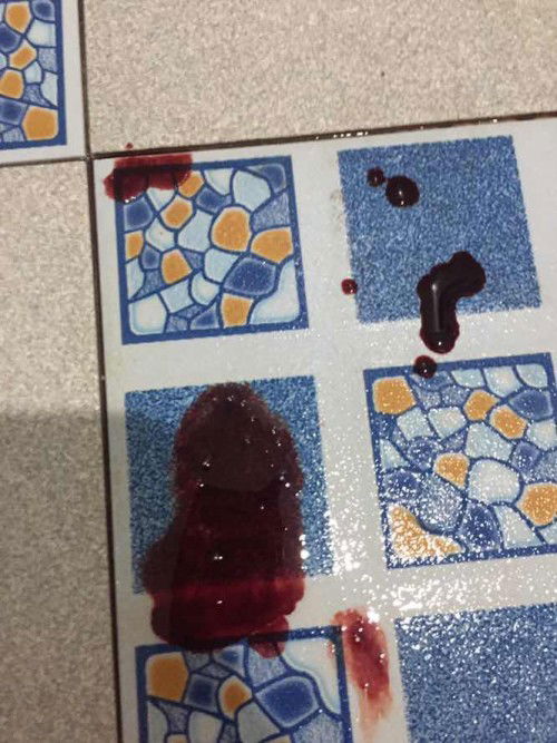 เป็นวันที่เสียใจที่สุด 7Week+3วัน 
หนูได้จากแม่ไป😔