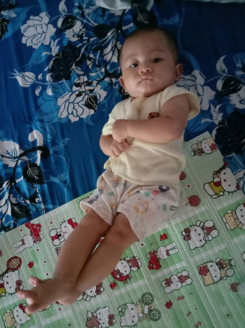 Bayi 6 bulan badannya kaku
