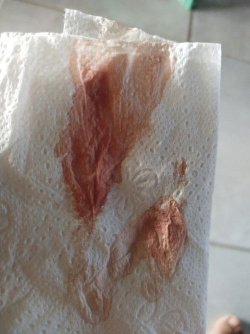 เลือดออกทุกครั้งที่ฉี่เสร็จ