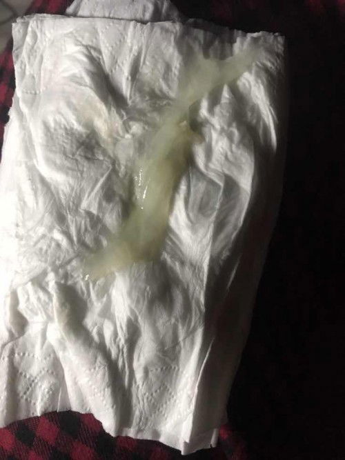 ท้องแรกค่ะ กลัวอัยตราย