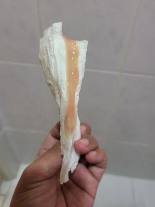 Mucus plug po ba ito?