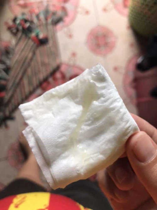 38+2มีมูกออกมาแบบนี้คืออะไรคะต้องไปโรงบาลไหม