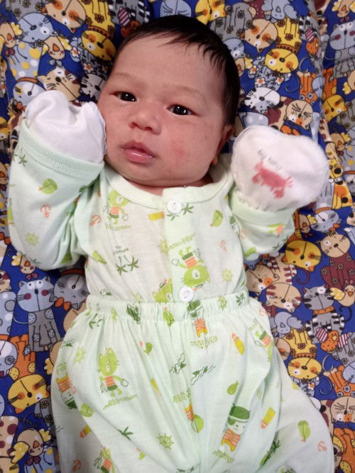 ผดผื่นที่ใบหน้าลูกค่ะ