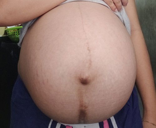 38 weeks and 1 day saken ng puson at balakang