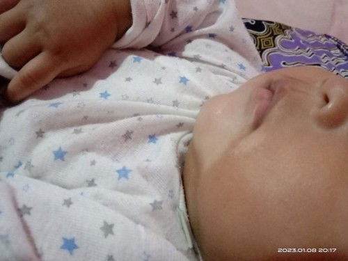 Mau tanya dong bund,,anak saya umur 4 bulan,,muka nya di bagian dagu ko putih belang gituu...itu ken