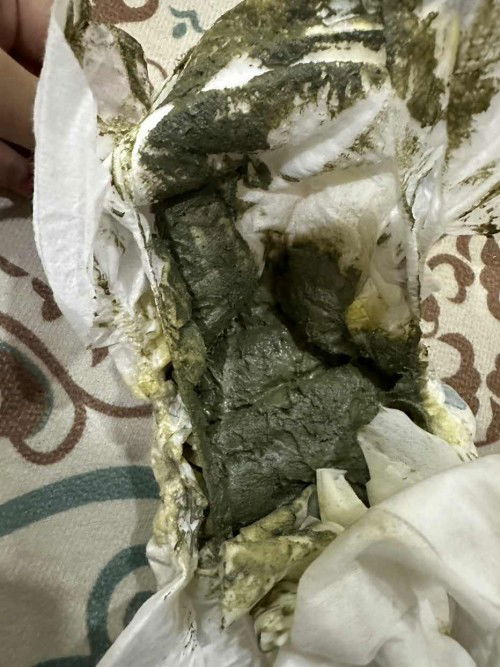 Maksud tahi anak normal atau tidak