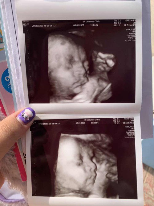 น้ำหนักลูกน้อยตามเกณฑ์ไหมคะ