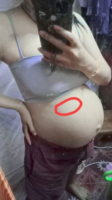 ปวดแสบๆตรงที่วง