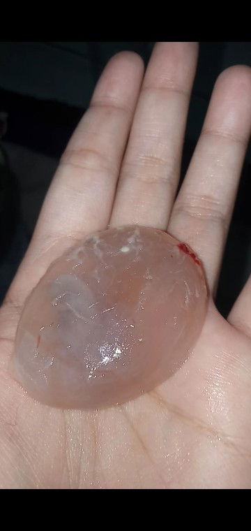 Gugur menjadi ibu untuk yg kedua kalinya di usia 14week💔