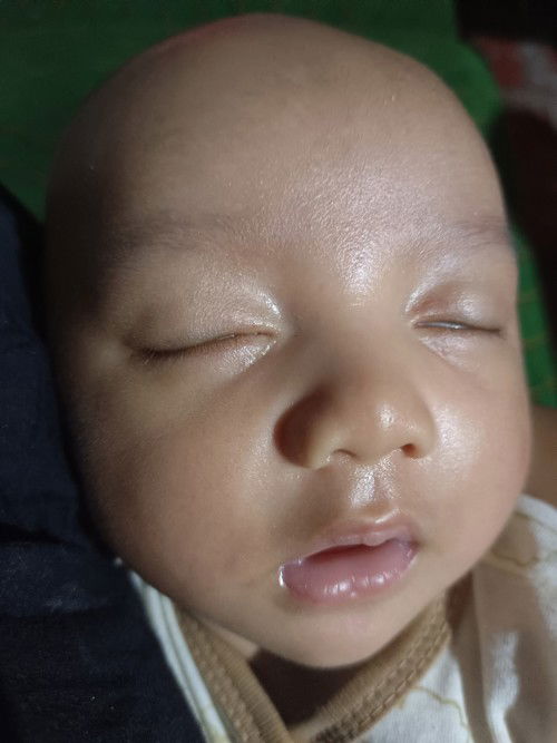 Warna hitam di bulu mata