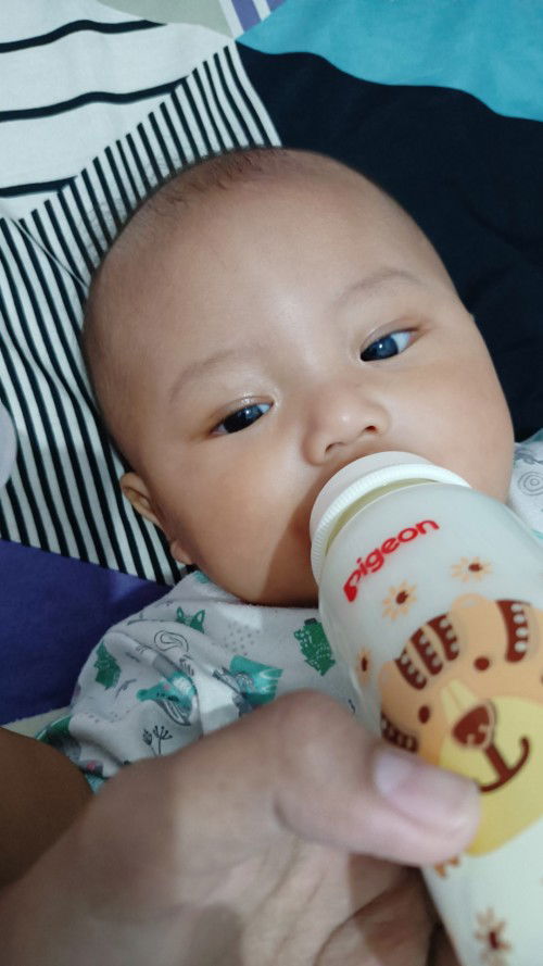 Seperti ada benjolan lunak di antara alis di atas hidung