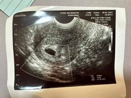 ขอดูใบซาวของแม่ แม่ 5-6 wk หน่อยค่า