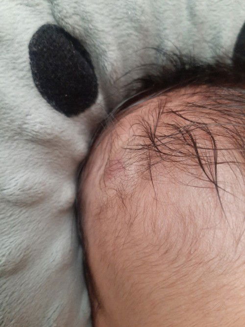 Kepala Bayi merah biru