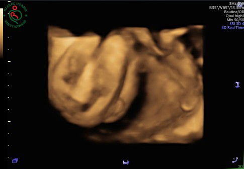 Aslammualaikum bunda2