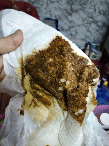 ขอสอบถามหน่อยค่ะเเม่ๆ