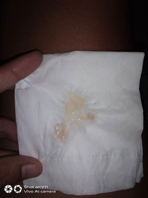 สอบถามแม่ๆหน่อยจ้า