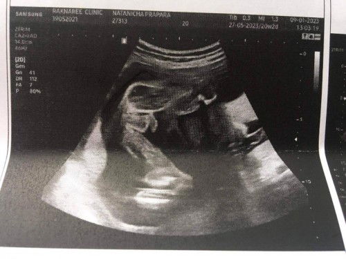 สอบถามแม่บ้านอื่นค่ะ เห็นเป็นจู๋ไหมคะ😂