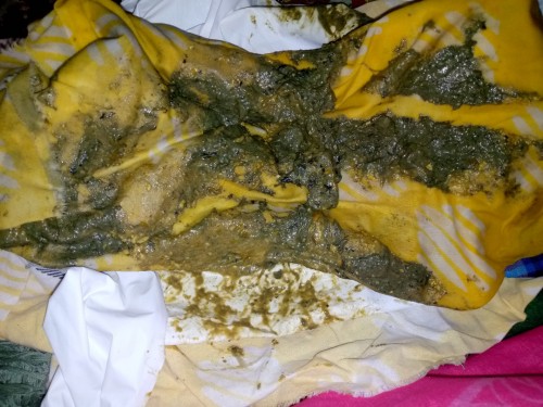 Anak saya kan dulunya ASI sekrang sufor merk vidoran.. tapi bab nya warnanya hijau ke abuan gitu