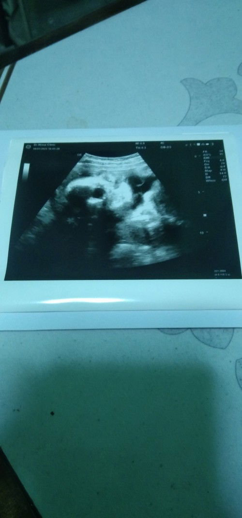 อยากสอบถามเเม่ๆเรื่องใบซาวด์ค๊าบ💗