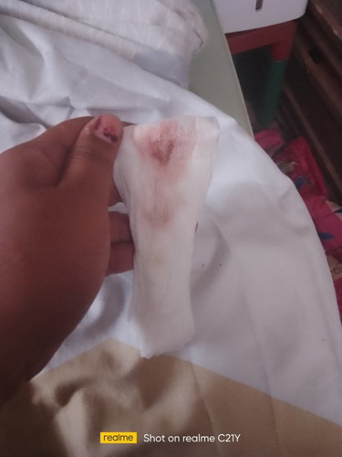 Implantation or period?