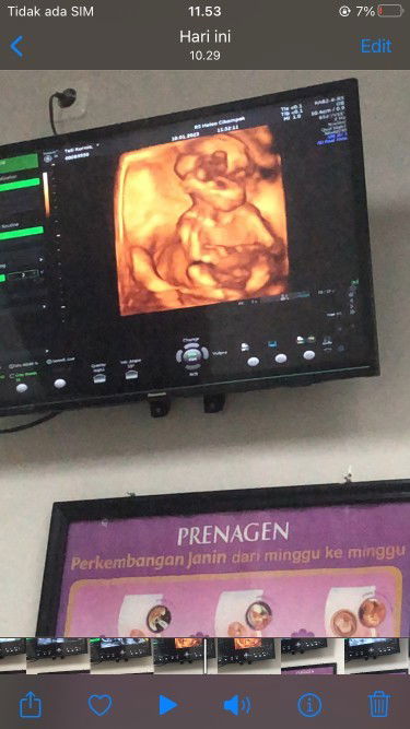 Sharing usia 16-17week