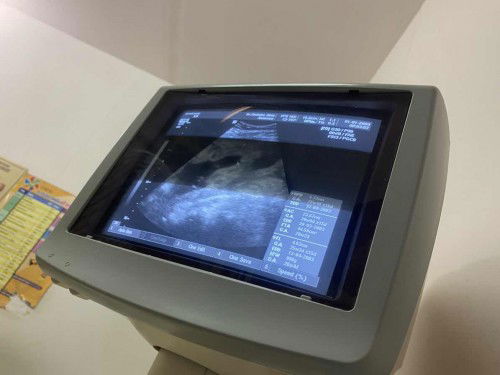 แม่ๆว่าชายหรือหญิงค่า หมอบอกผู้ชายค้าบบบ  ส่วนตัวอยากได้ผู้ชายค่าา ❤️❤️