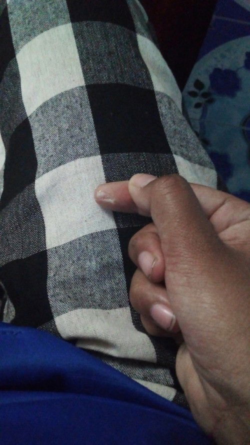 อันนี้คือตกขาวหรือมูกใสค่ะ
ตอนนี้ได้35w+6d
#ขออภัยที่เล็บดำ😅