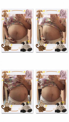 ปกติเเม่ๆผ่าคลอดกันกี่วีคค่ะ