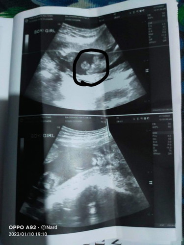 Gender "?"