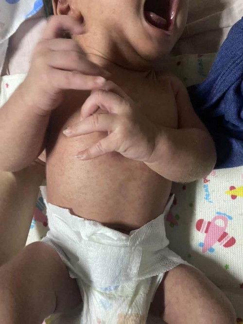 สอบถามแม่ๆค่ะ