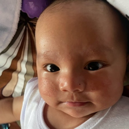 Pa help po
Ano po kaya pwede gamot sa baby ko ?