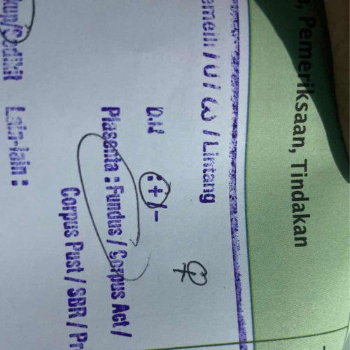 Halo bun , maaf saya mau bertanya DN + itu artinya apa ya bun?