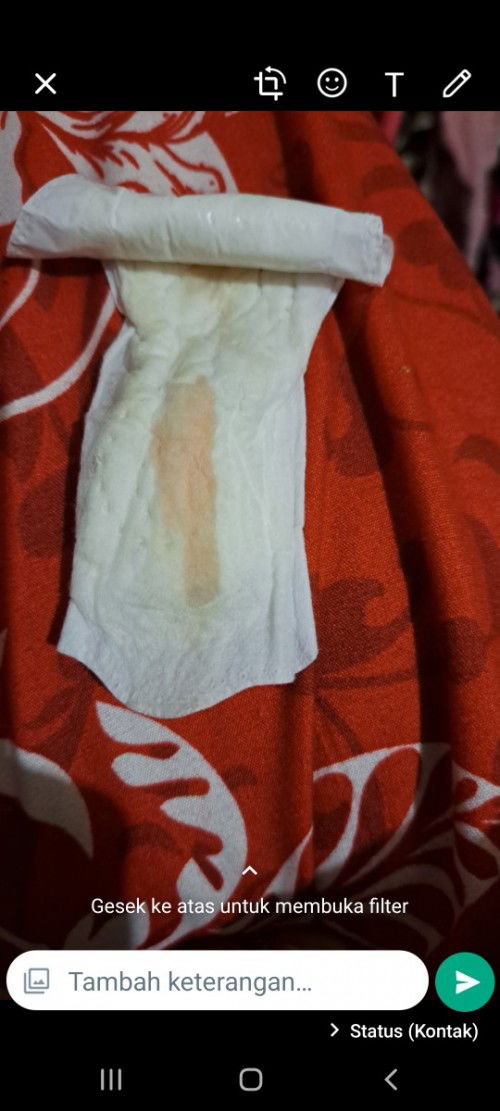 Ini flek ga bun? 9w4h padahal kemarin baru usg, denyut jantung baik dan janin sudah terlihat baik.