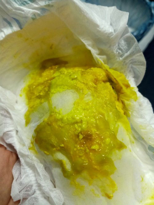 normal ke jika najis anak macam ni