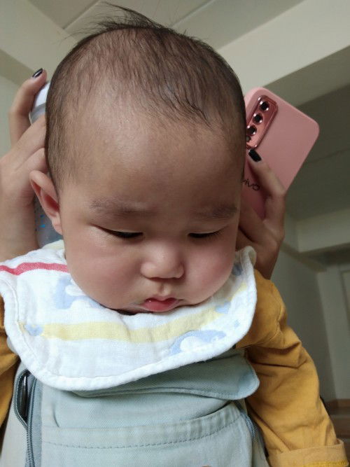 น้องเป็นผื่นขึ้นตามตัว ไม่มีไข้