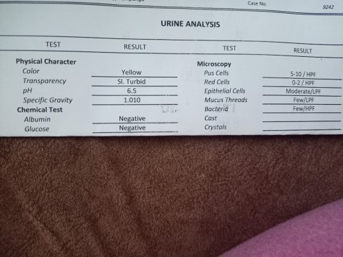 URINALYSIS RESULT