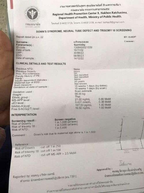 ผลดาวซินโดรม